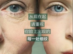 美國DMK