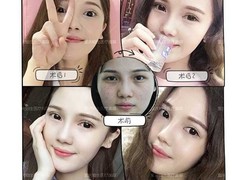 上海MiuMiu整形医美 