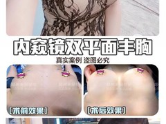 郑州好的眼综合鼻综合医美整形医院