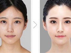 上海MiuMiu整形医美 