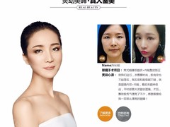 上海MiuMiu整形医美 