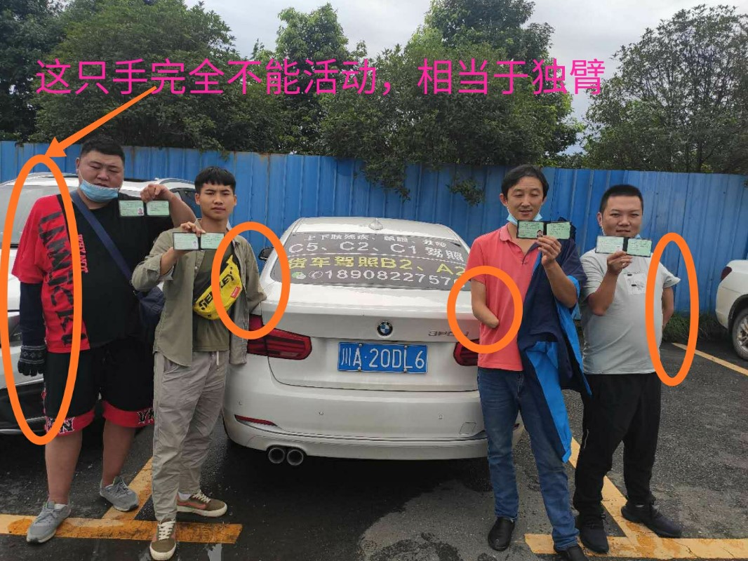 独臂考c5驾照_成都残疾人驾校上肢下肢残疾c5c2c1