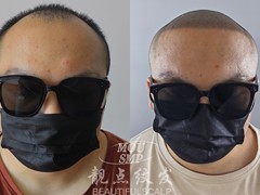 靓点3D纹发
