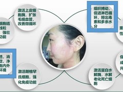 美国DMK
