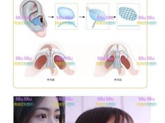 上海MiuMiu整形医美 