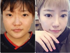 上海MiuMiu整形医美 