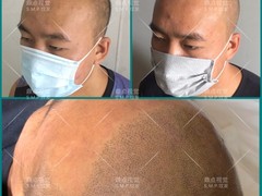 SMP纹发连锁 